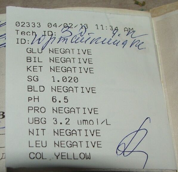 Meine Urinanalyse führt vor Femixal